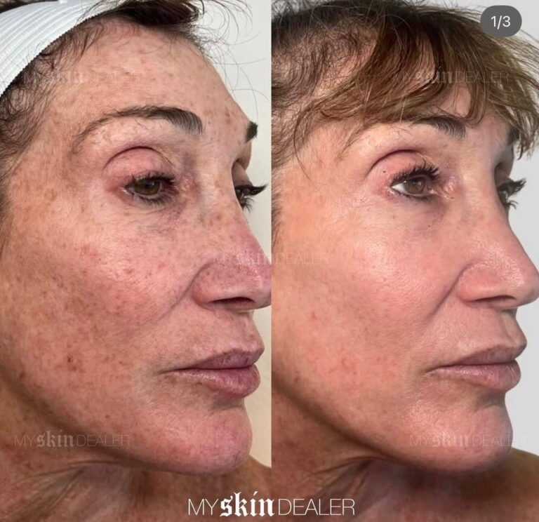 Local Guide to Best Estheticians in Boca & Delray